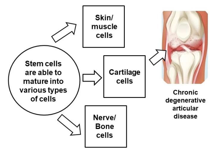 干细胞治疗膝骨关节炎已成全球趋势 2.jpg